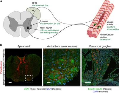 Molecular Mechanisms Underlying Sensory-Motor Circuit Dysfunction in SMA